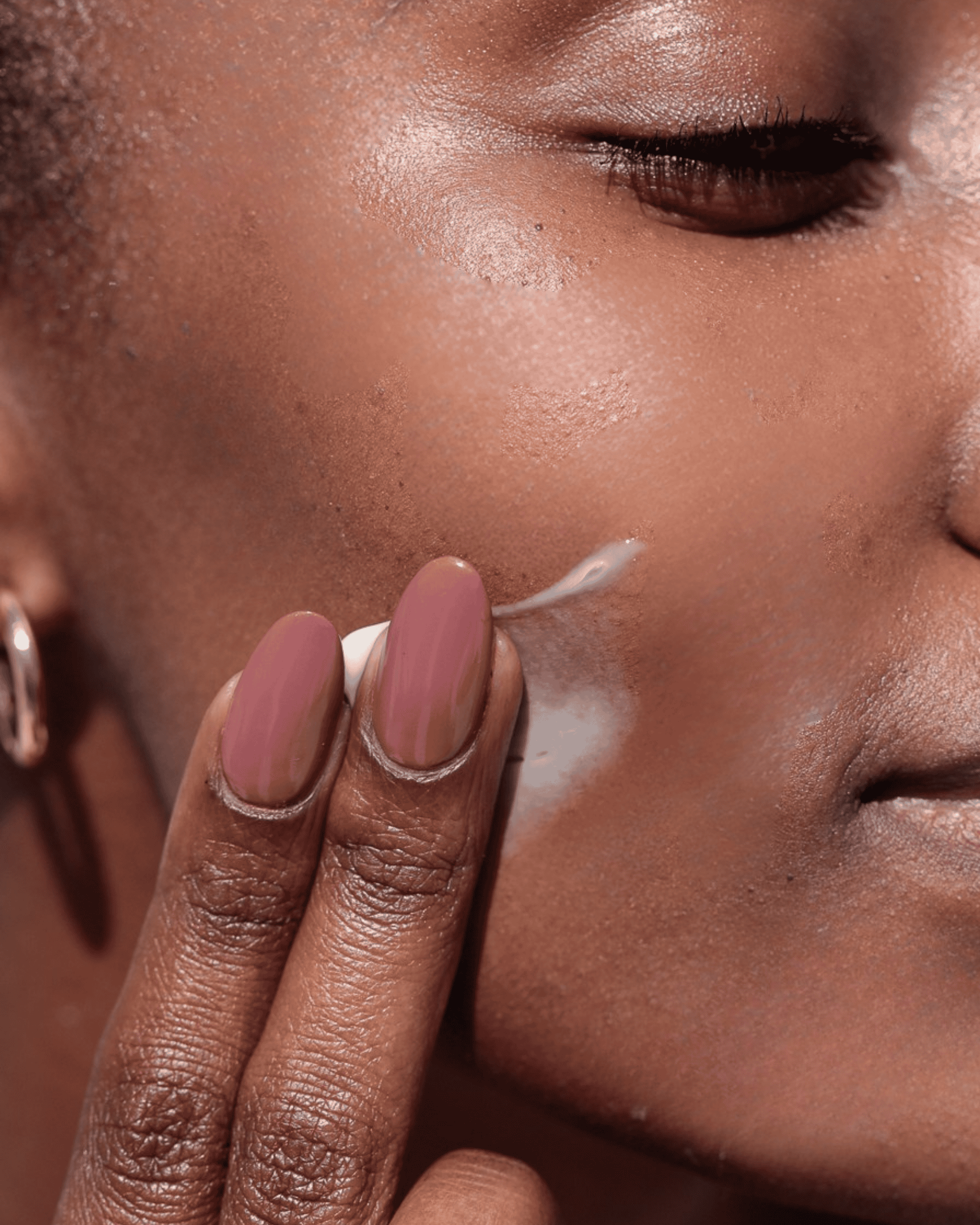 Dry/Dehydrated Skin